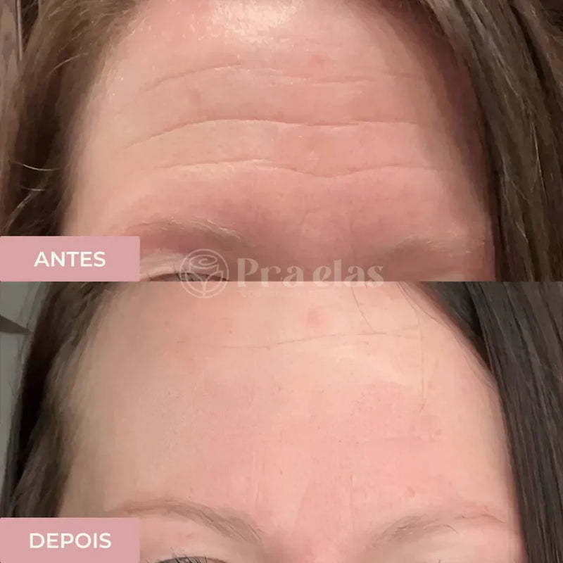 Creme Antirrugas