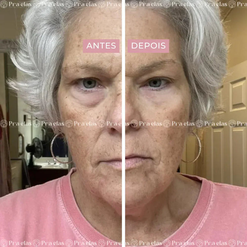 Creme Antirrugas