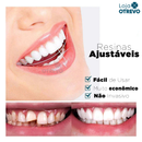 (Compre 1 Leve 2) Lente Dental Ajustável - Inferior e Superior | BRINDE CAPINHA PROTETORA + FRETE GRÁTIS!